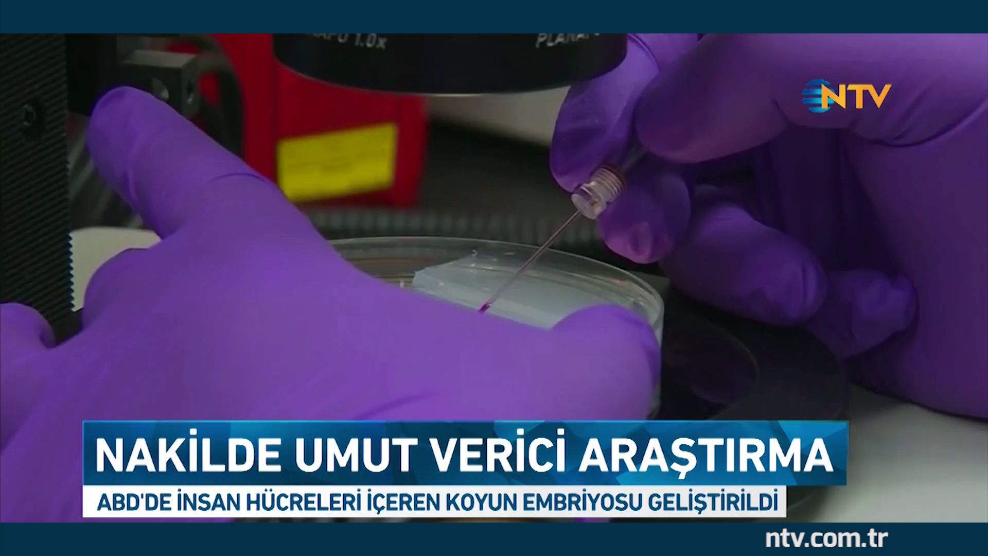 Sağ Böbrek Büyümesi Sağ Böbrek Büyümesi